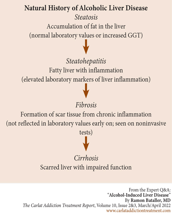 Diagram: Natural History of Alcoholic Liver Disease